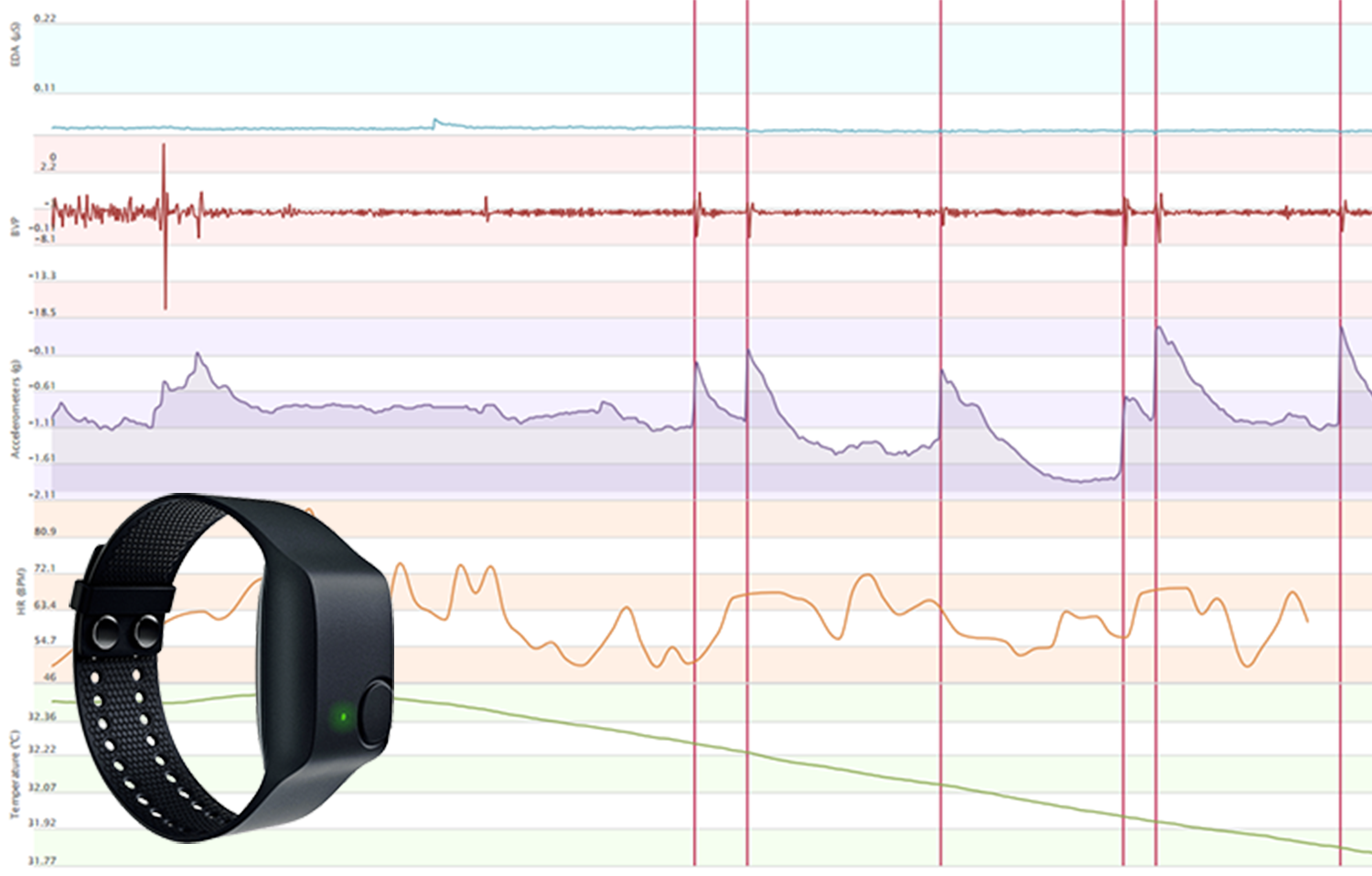 Empatica E4 data and device.